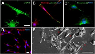 Chemotactic TEG3 Cells’ Guiding Platforms Based on PLA Fibers Functionalized With the SDF-1α/CXCL12 Chemokine for Neural Regeneration Therapy